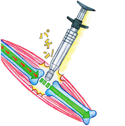 自律神経失調症　克服　整体　横浜　改善 治療院　治療